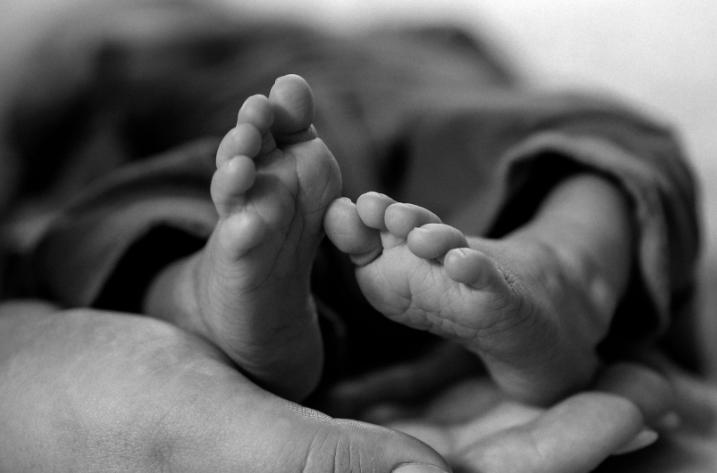 Medical conditions that people mistake as signs of infant abuse